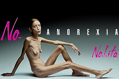 ایزابل کارو، بازیگر و مدل فرانسوی است که به خاطر گرایش به لاغری به  بیماری بی‌اشتهایی (anorexia ) دچار شده